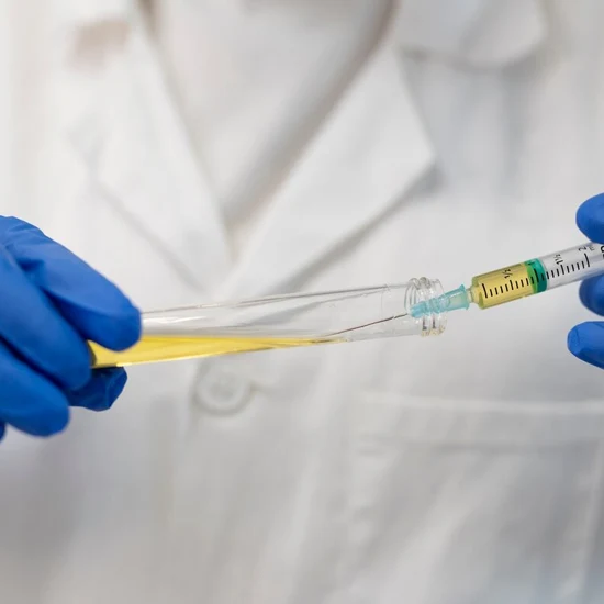 Urine Spot Creatinine test